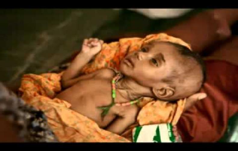 One month old baby poured with Acid to cure Pneumonia in Saw...